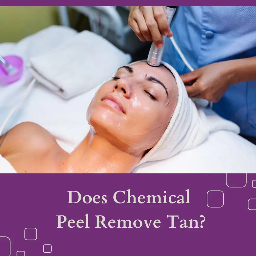 Does Chemical Peel Remove Tan? Essence Aesthetic Clinic