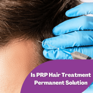 Is-PRP-Hair-Treatment-Permanent-Solution