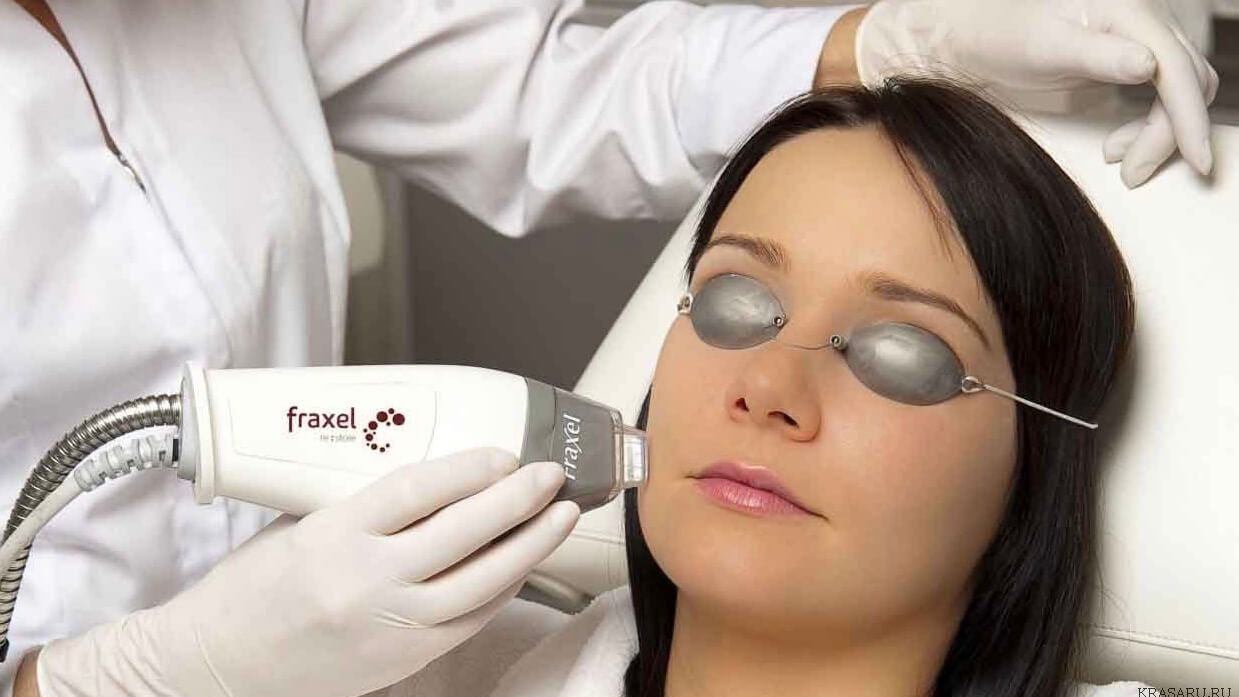 Fraxel-Laser-Santa-Monica-Skin-Care-Center (1)