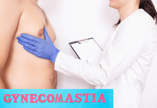 Gynecomastia