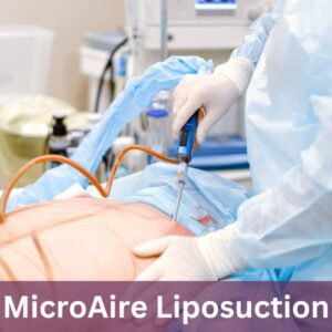 MicroAire liposuction