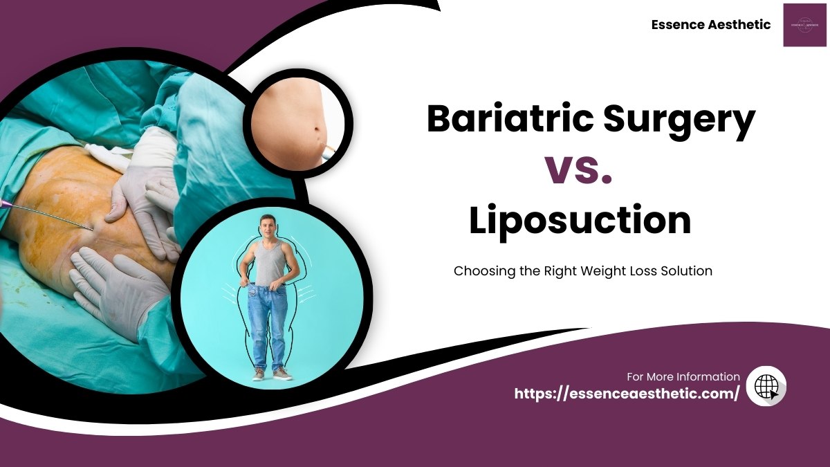 bariatric surgery vs liposuction