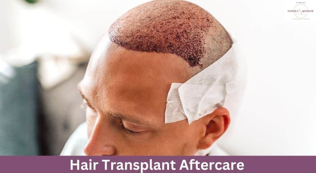 Hair Transplant Aftercare