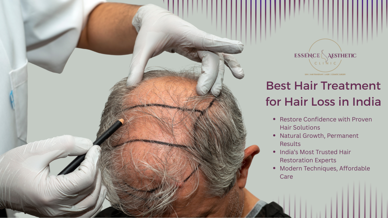 Best hair transplant services