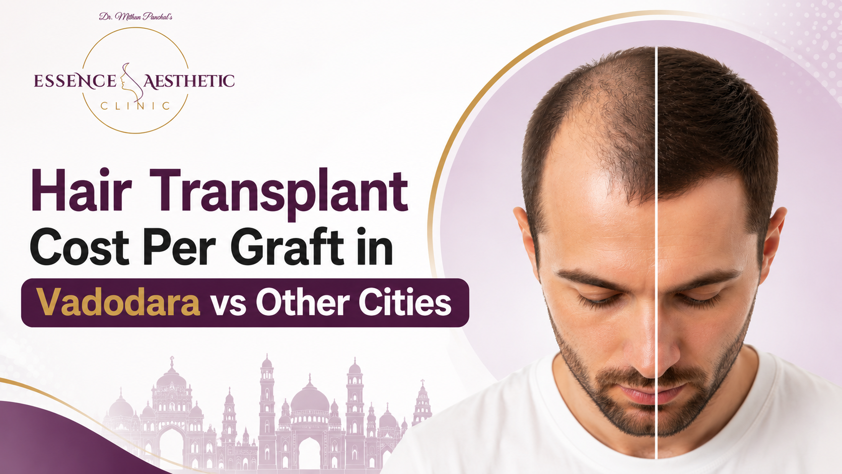 cost of hair transplant per graft