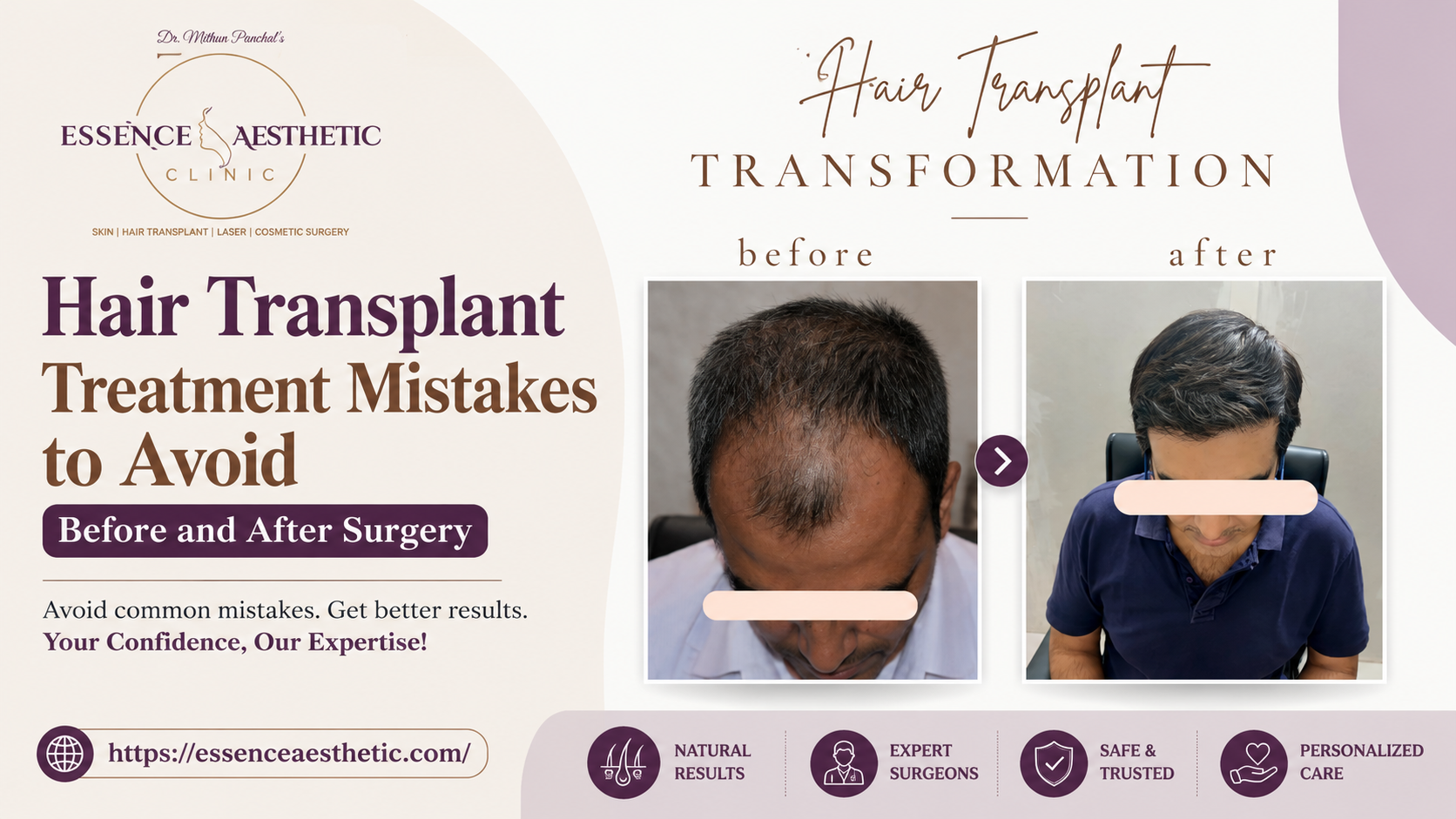 hair transplant treatment
