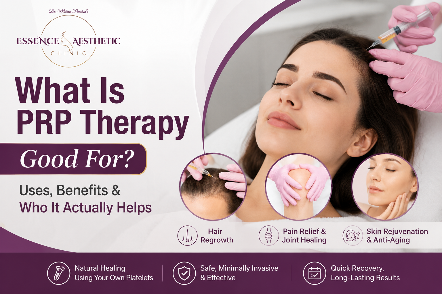 What is prp therapy
